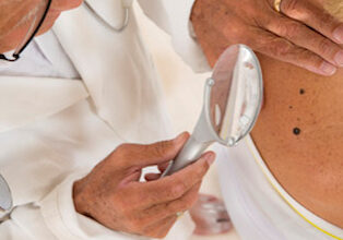 dermatologist