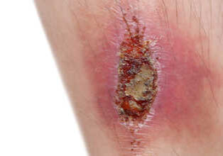 isolated wounded leg in white background isolated wounded leg in white background